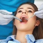 How To Prepare For Root Canal Treatment
